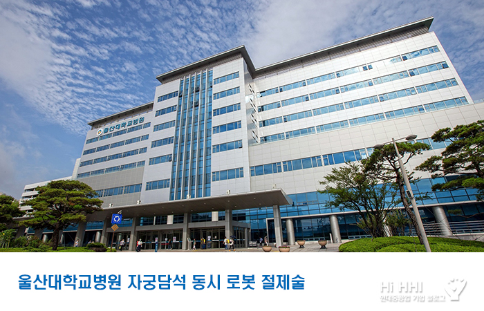 울산대학교병원 _자궁담석 동시 로봇 절제술_